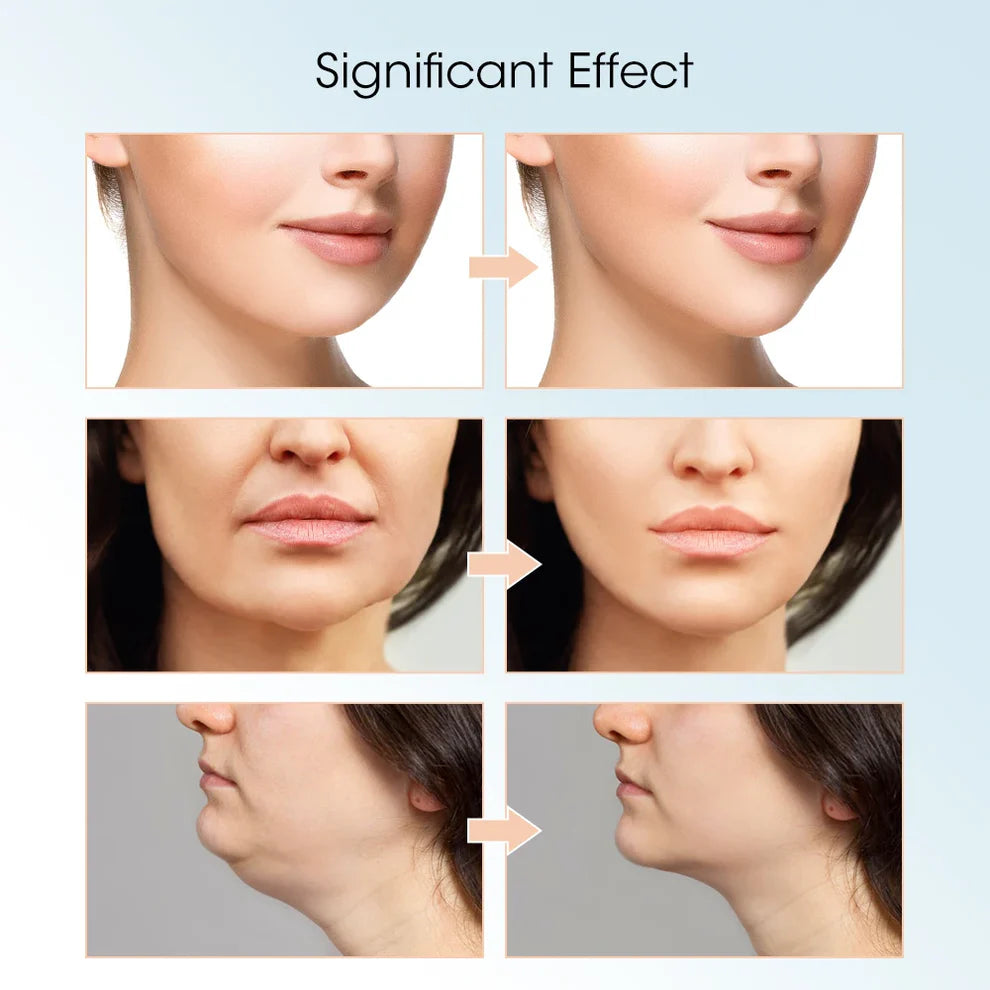 MASAJEADOR DE PAPADA Y ESTIRAMIENTO FACIAL